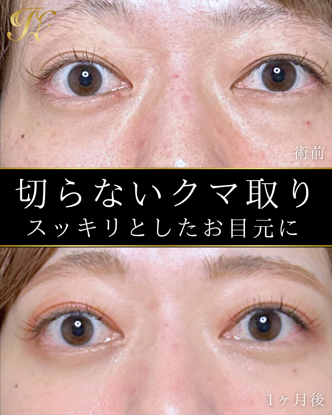 症例イメージ