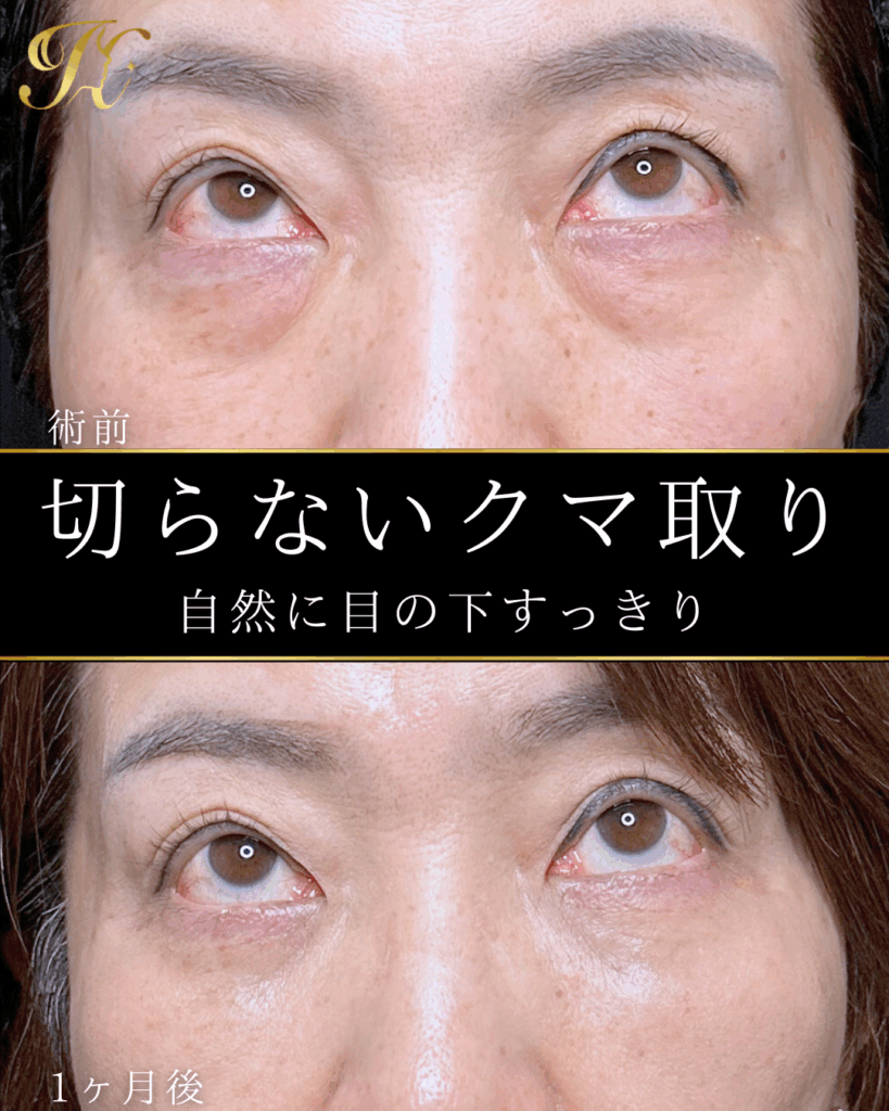 症例イメージ