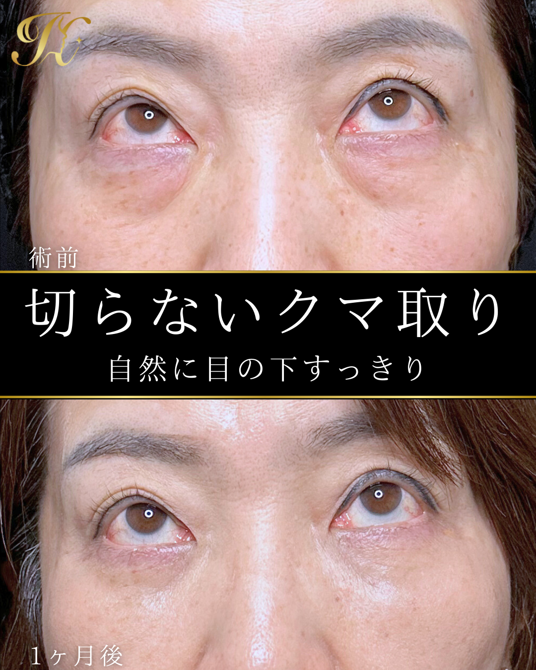 症例イメージ