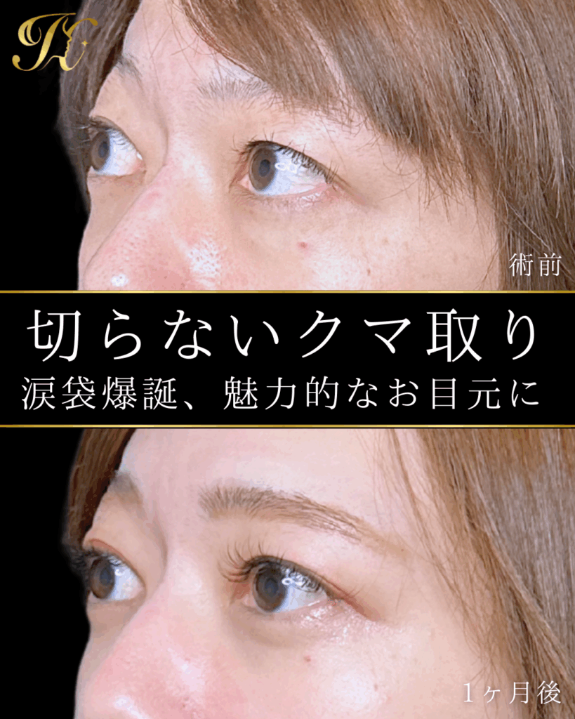 症例イメージ