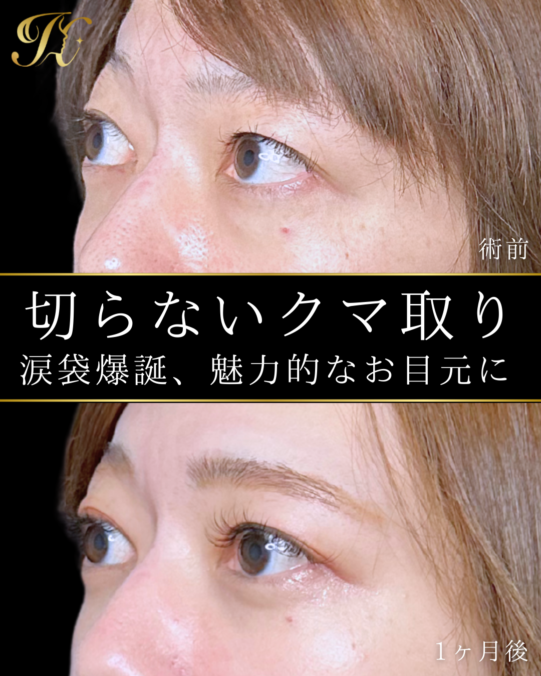 症例イメージ