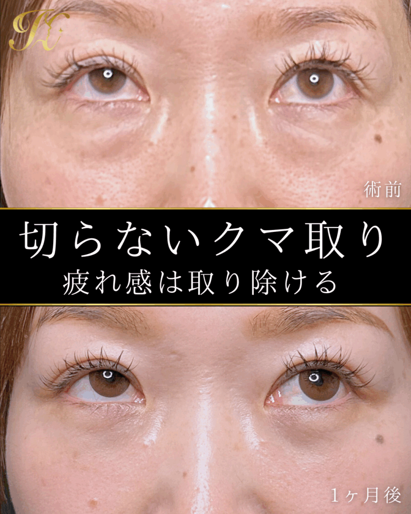 症例イメージ