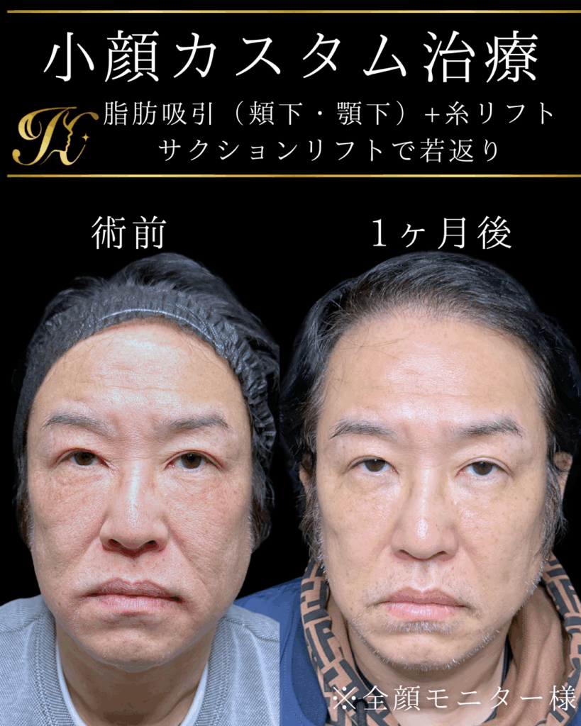 症例イメージ