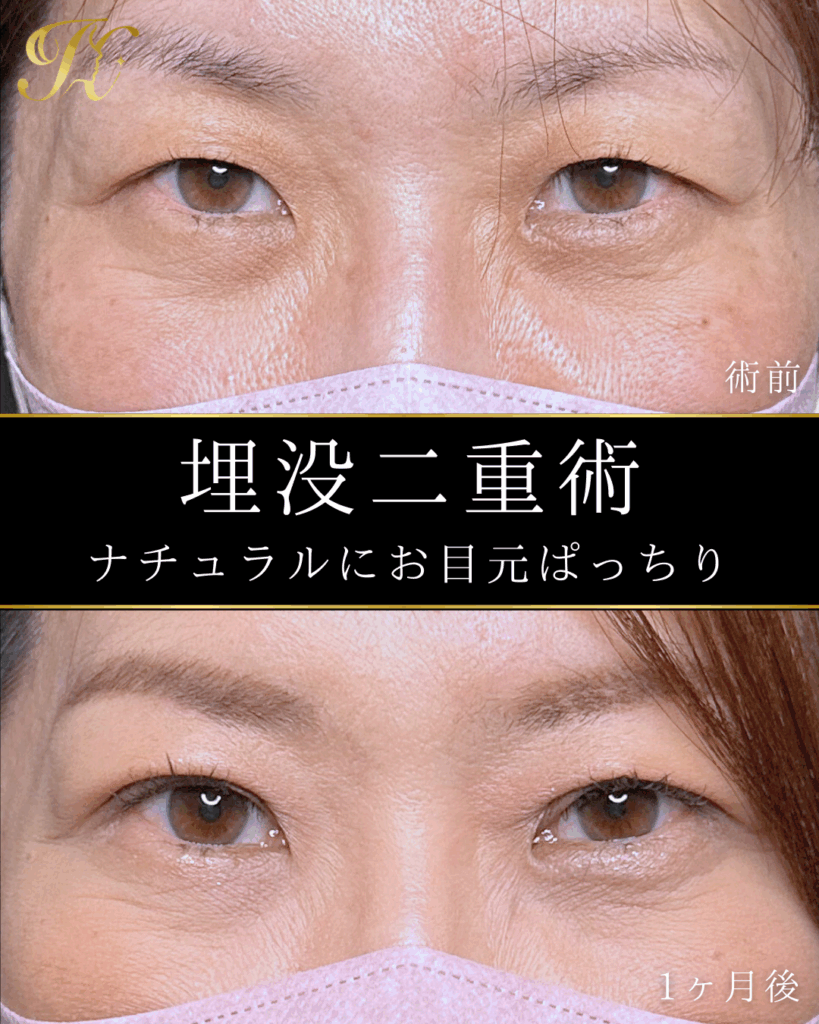 症例イメージ
