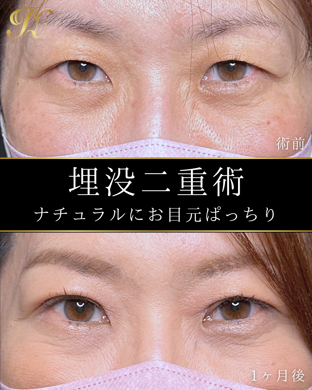 症例イメージ