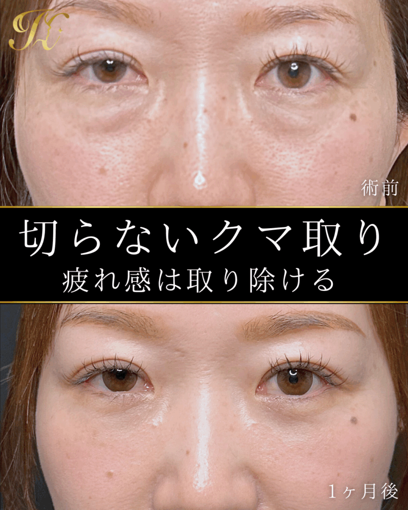 症例イメージ