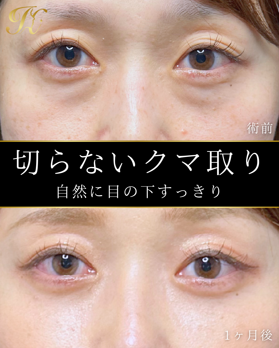 症例イメージ
