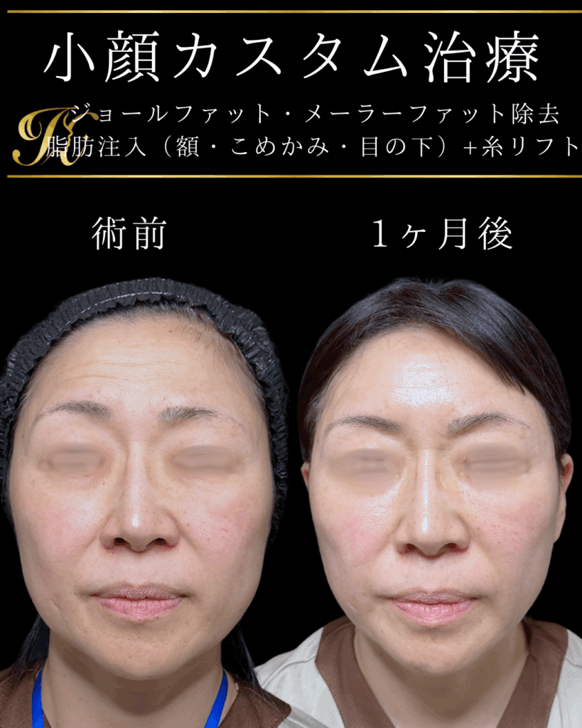 症例イメージ