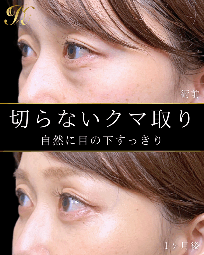 症例イメージ