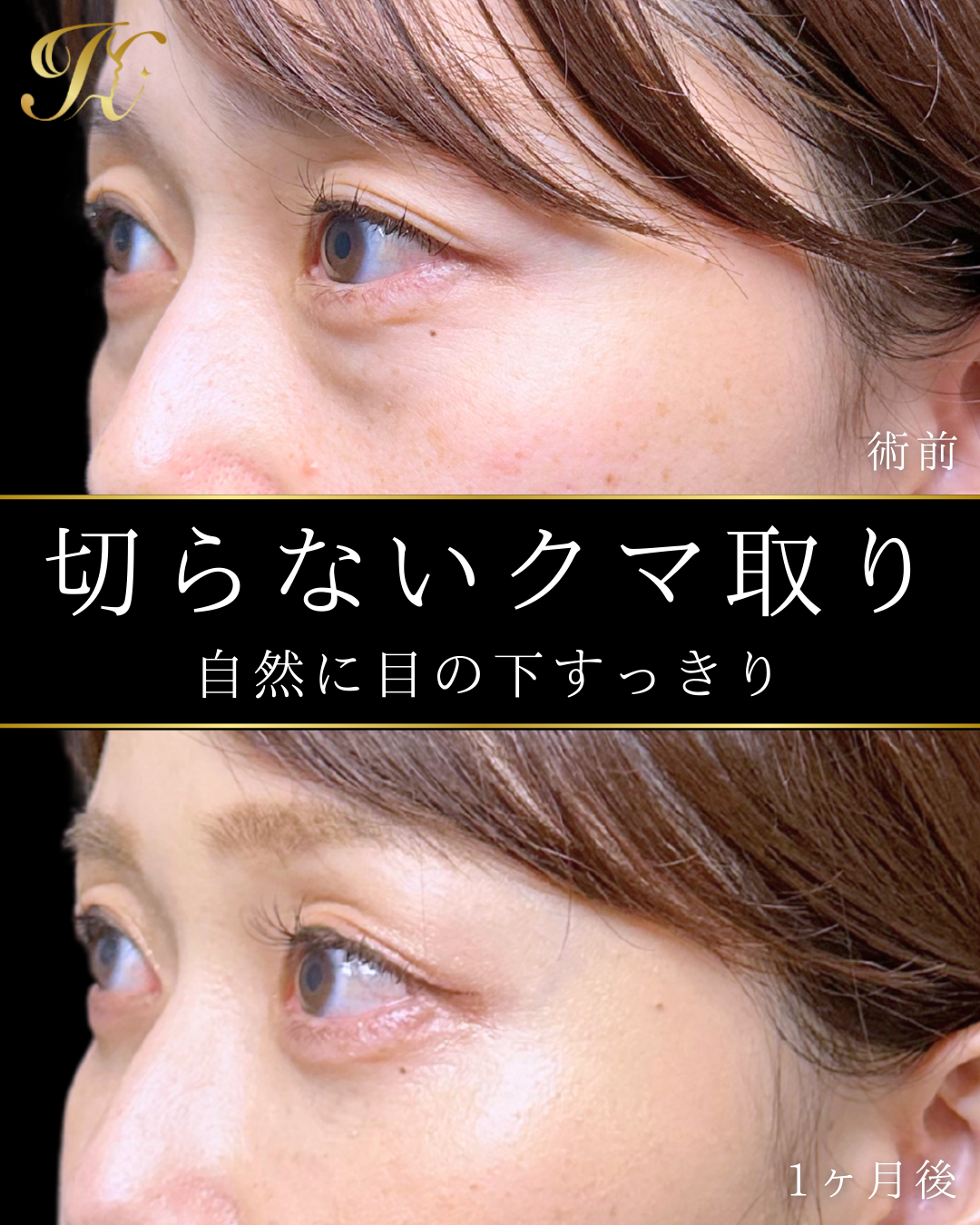 症例イメージ