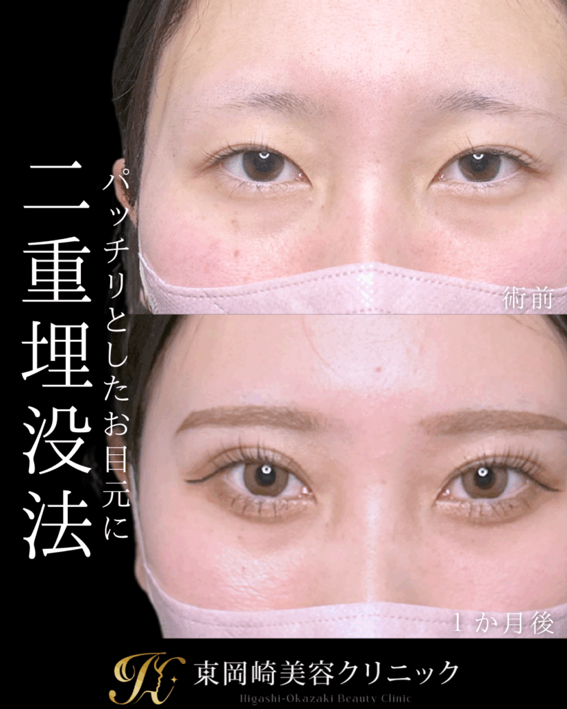 症例イメージ
