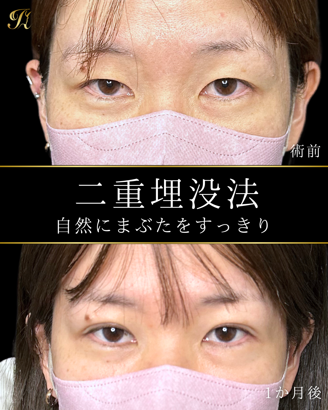 症例イメージ