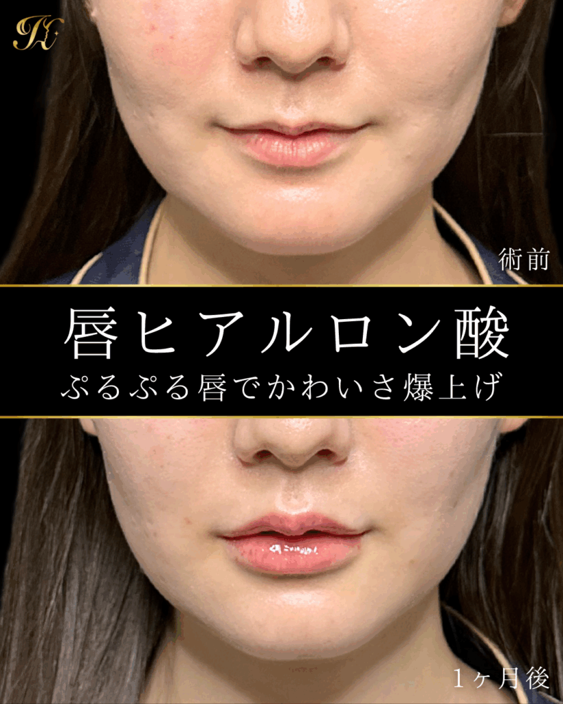症例イメージ