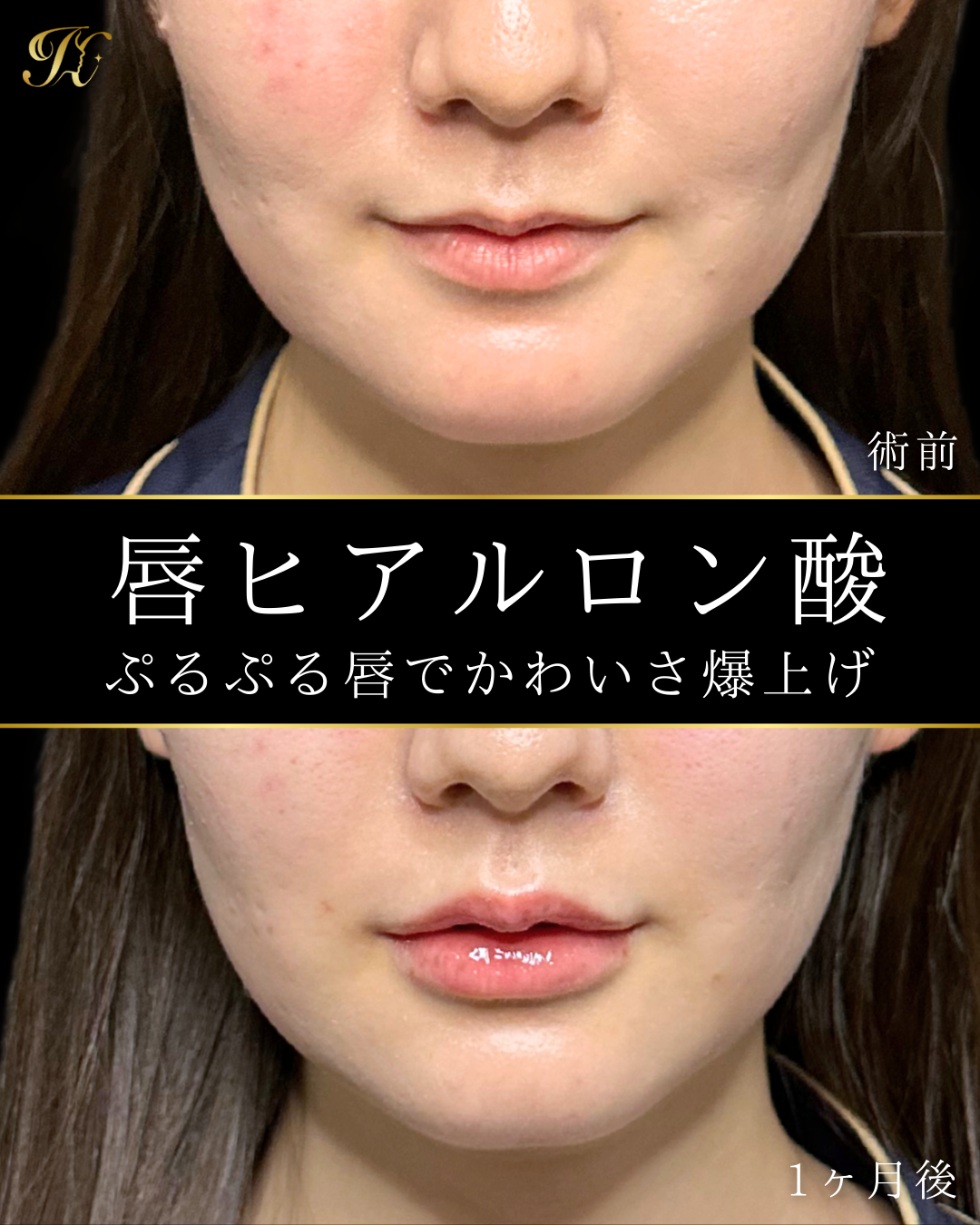 症例イメージ