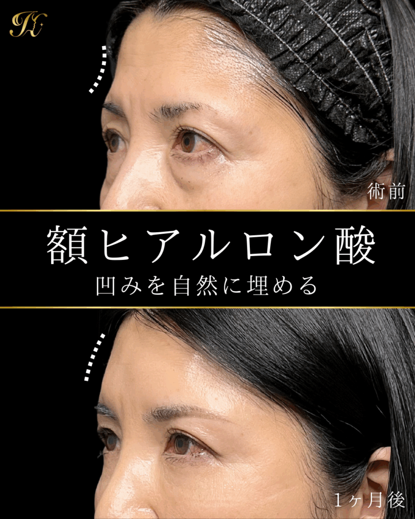 症例イメージ