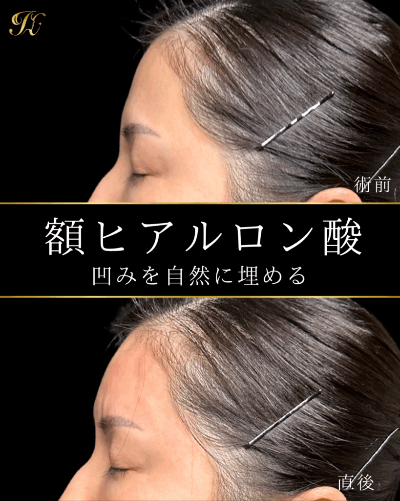 症例イメージ