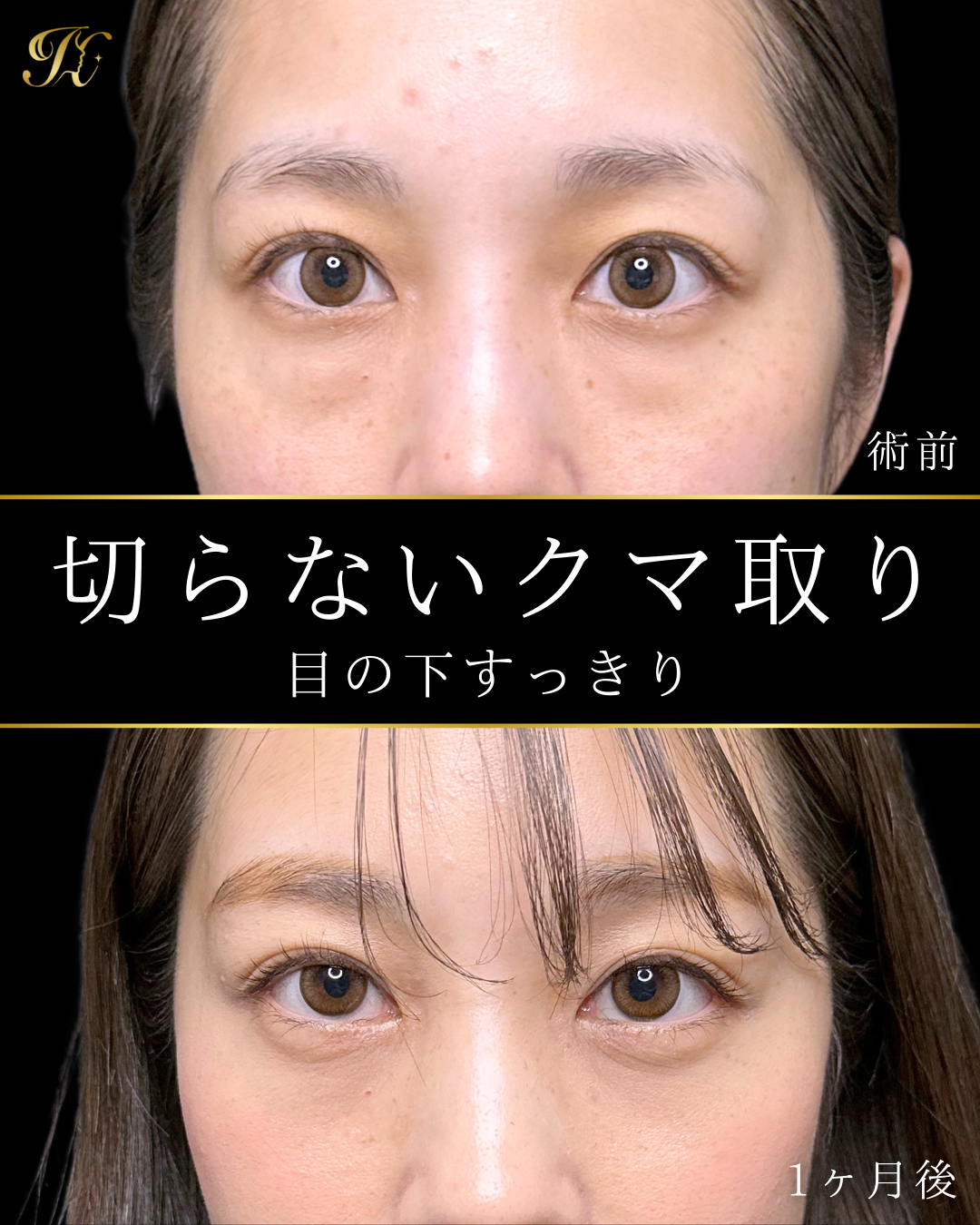 症例イメージ
