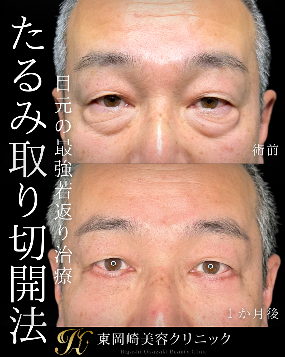 症例イメージ