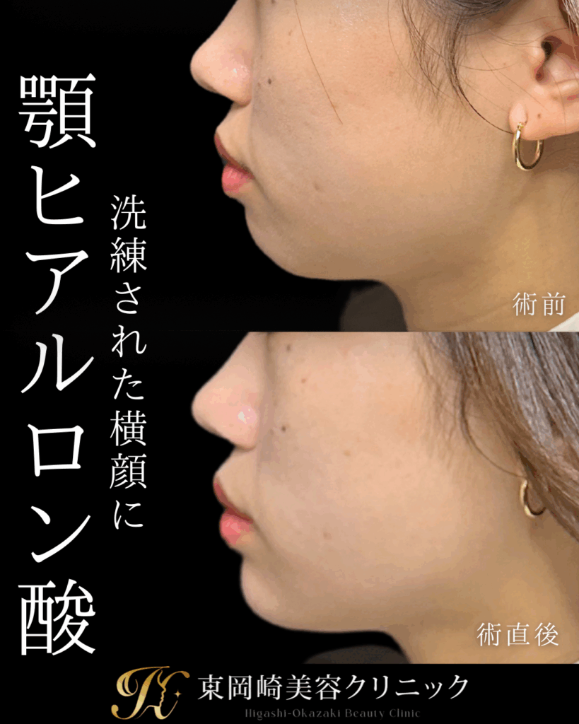 症例イメージ
