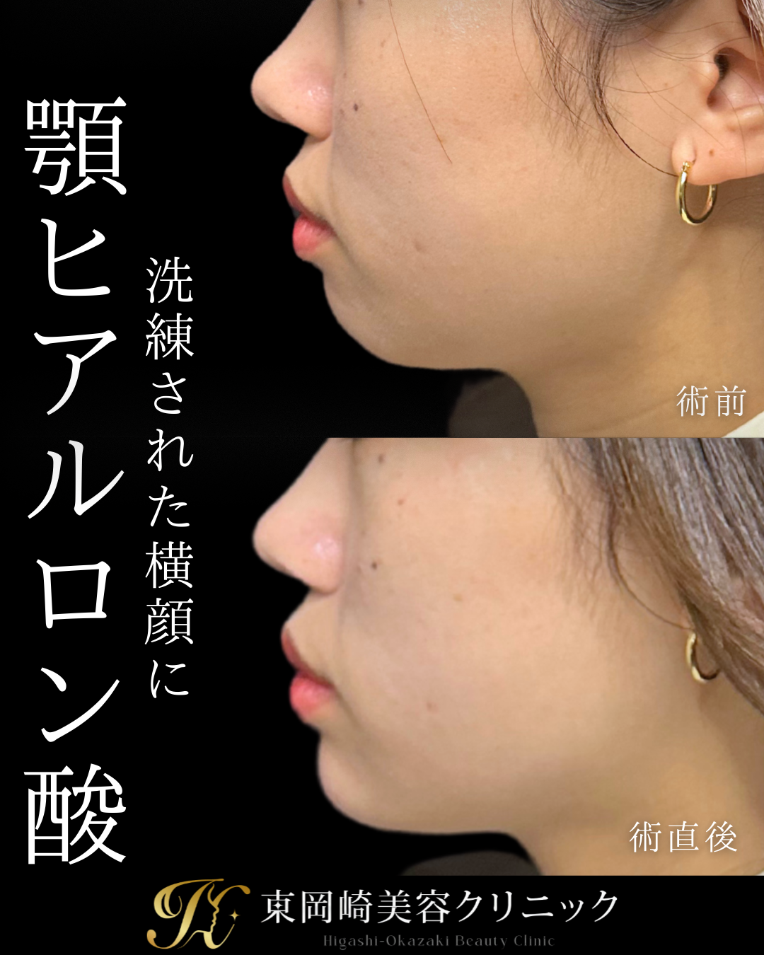 症例イメージ