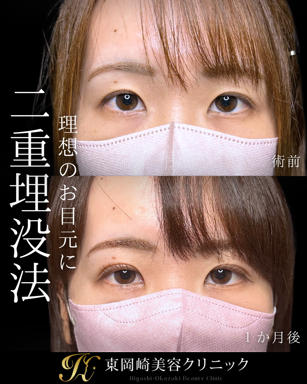 症例イメージ