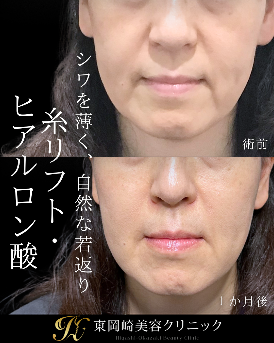 症例イメージ