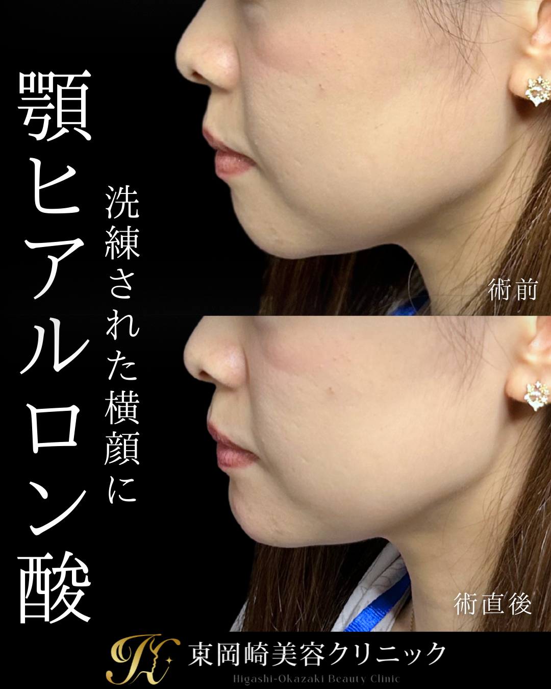 症例イメージ