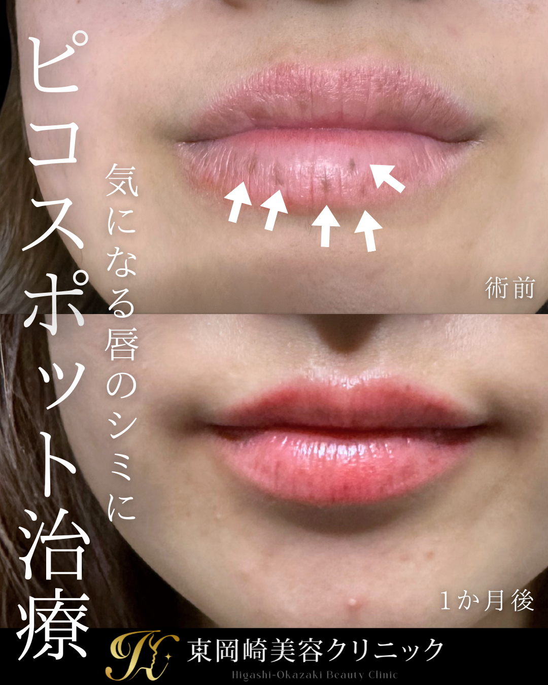 症例イメージ