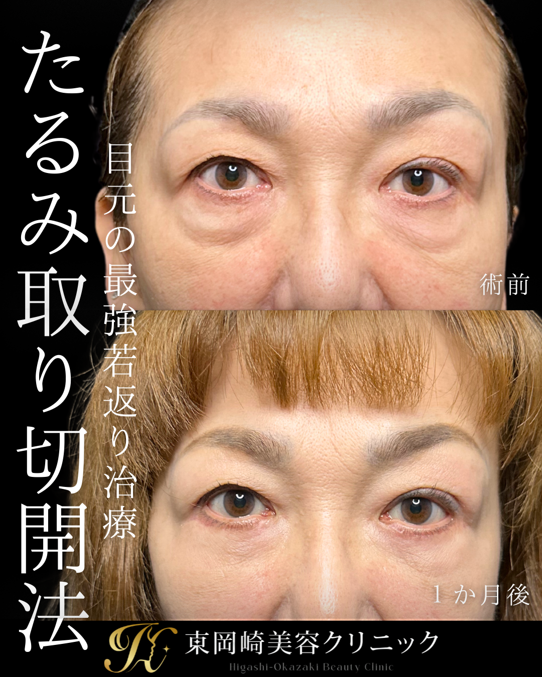 症例イメージ