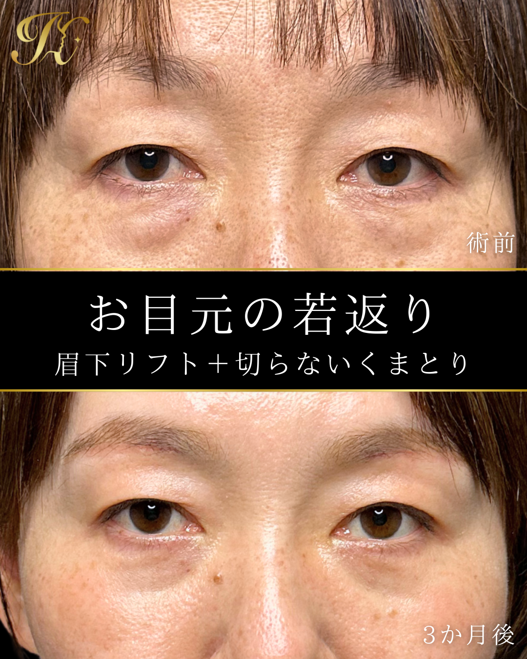 症例イメージ