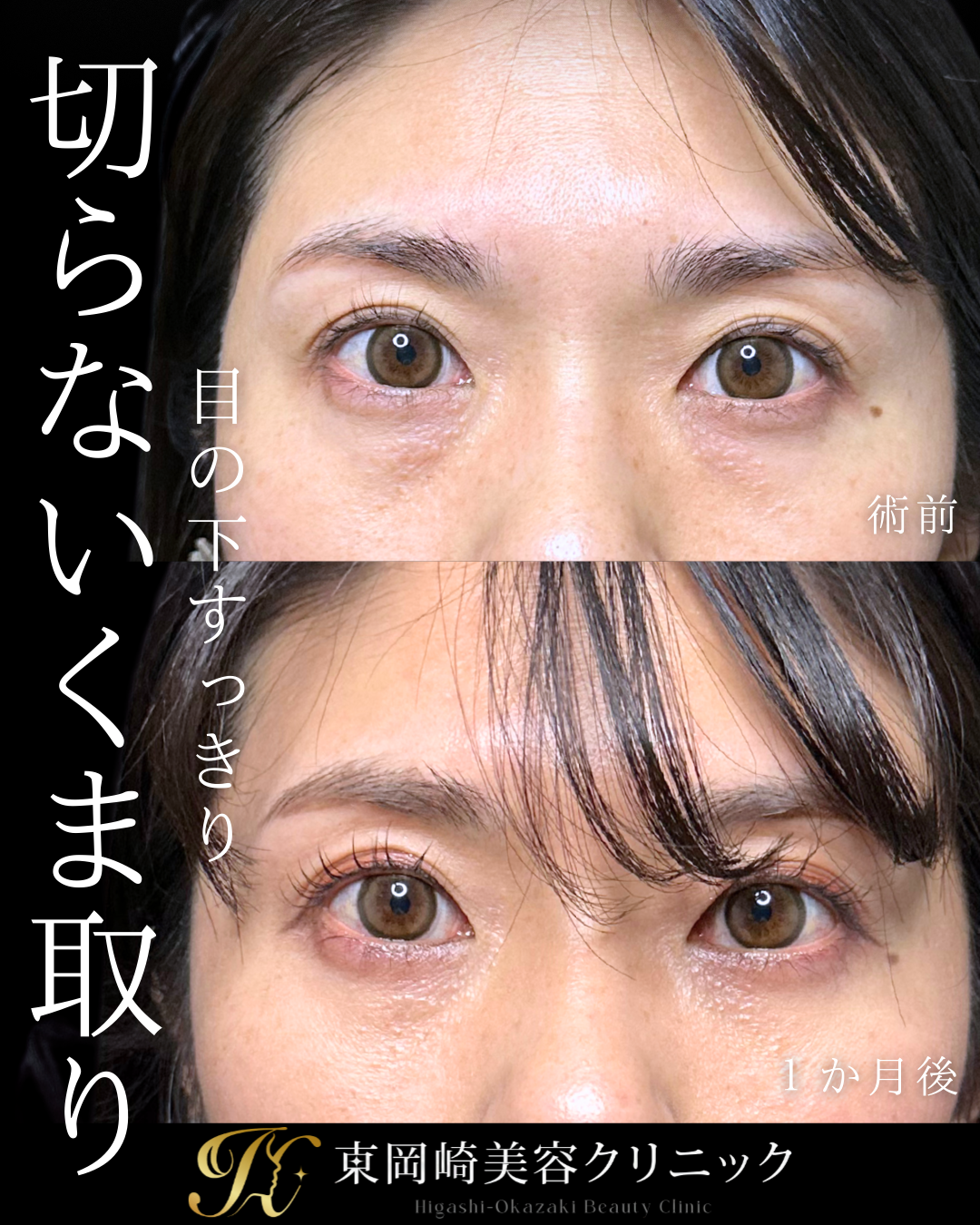 症例イメージ