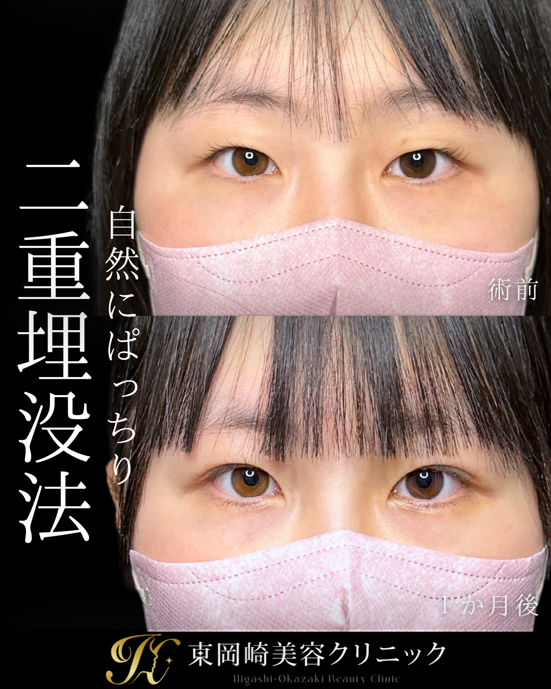 症例イメージ