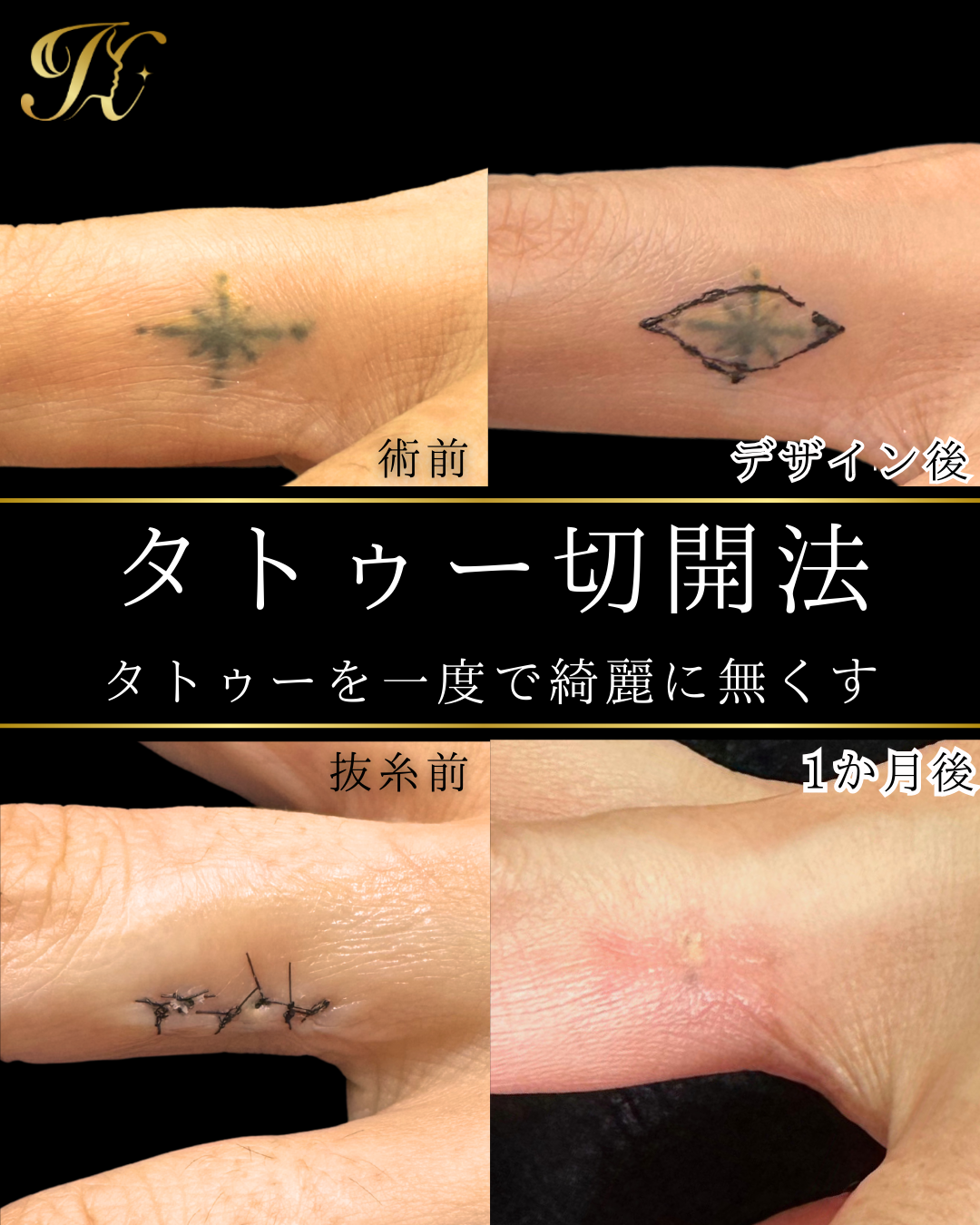 症例イメージ