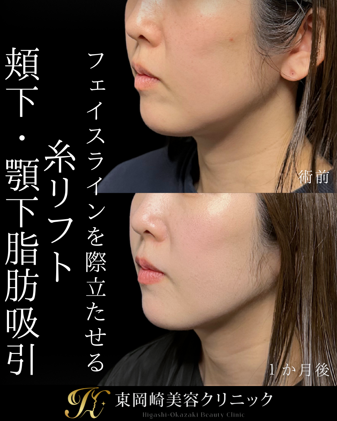 症例イメージ