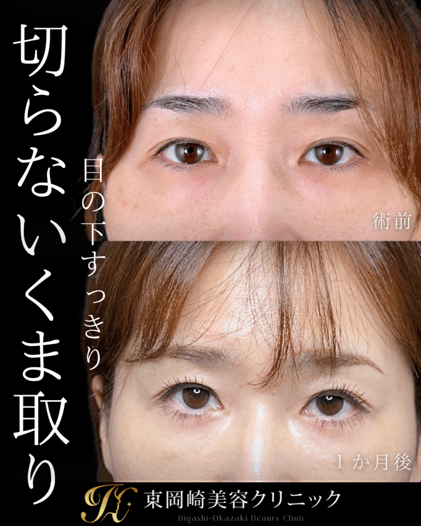 症例イメージ
