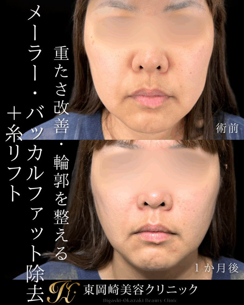 症例イメージ