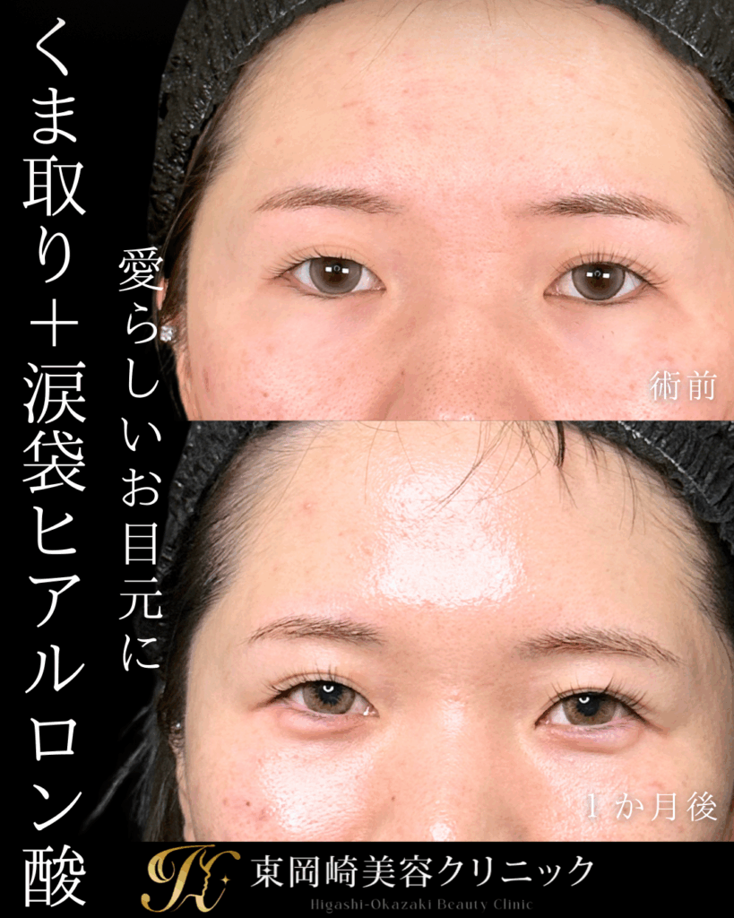 症例イメージ