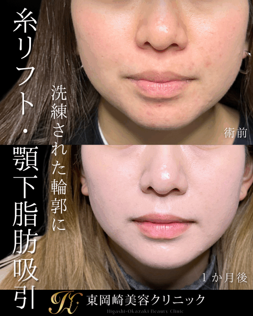 症例イメージ