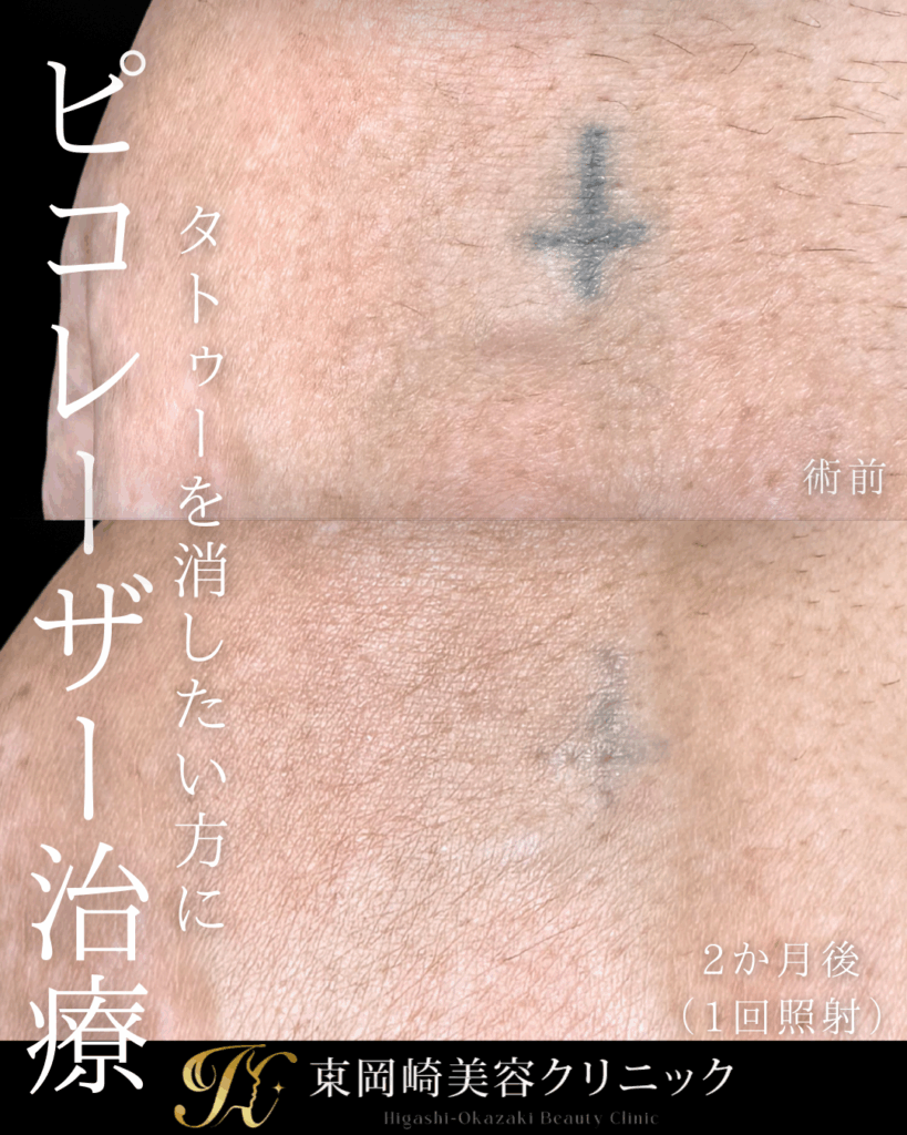 症例イメージ