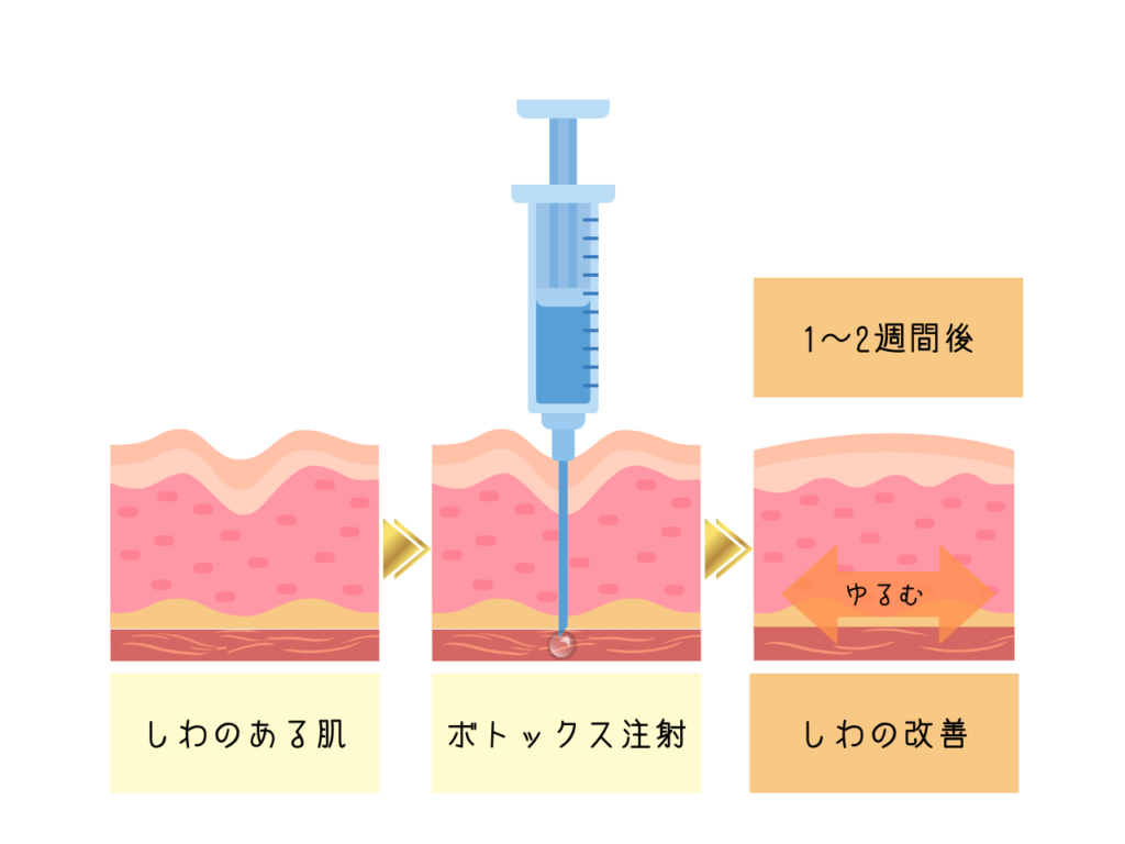 皮膚の断面図イメージ