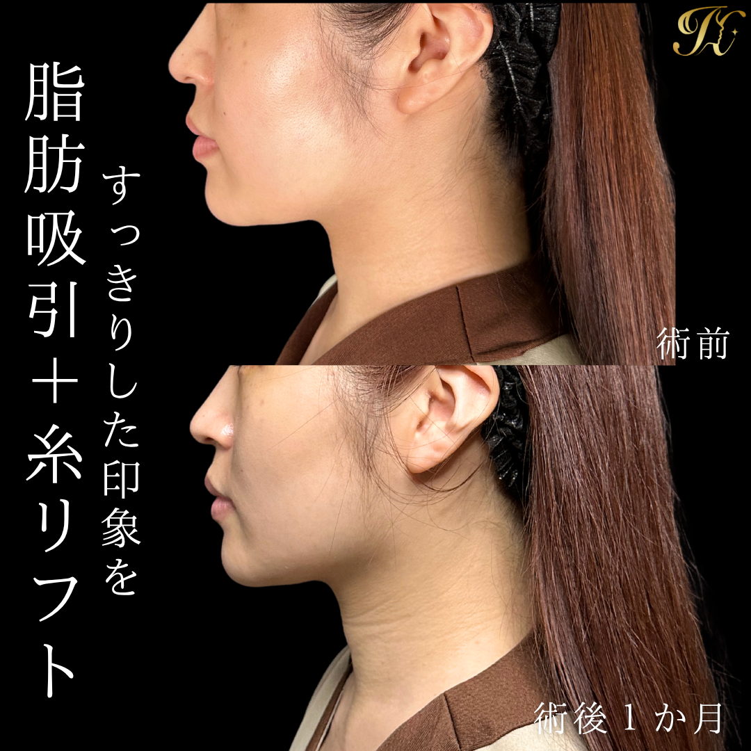 症例イメージ