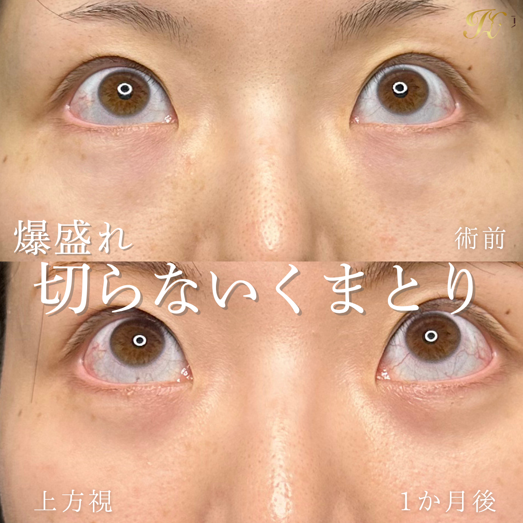 症例イメージ