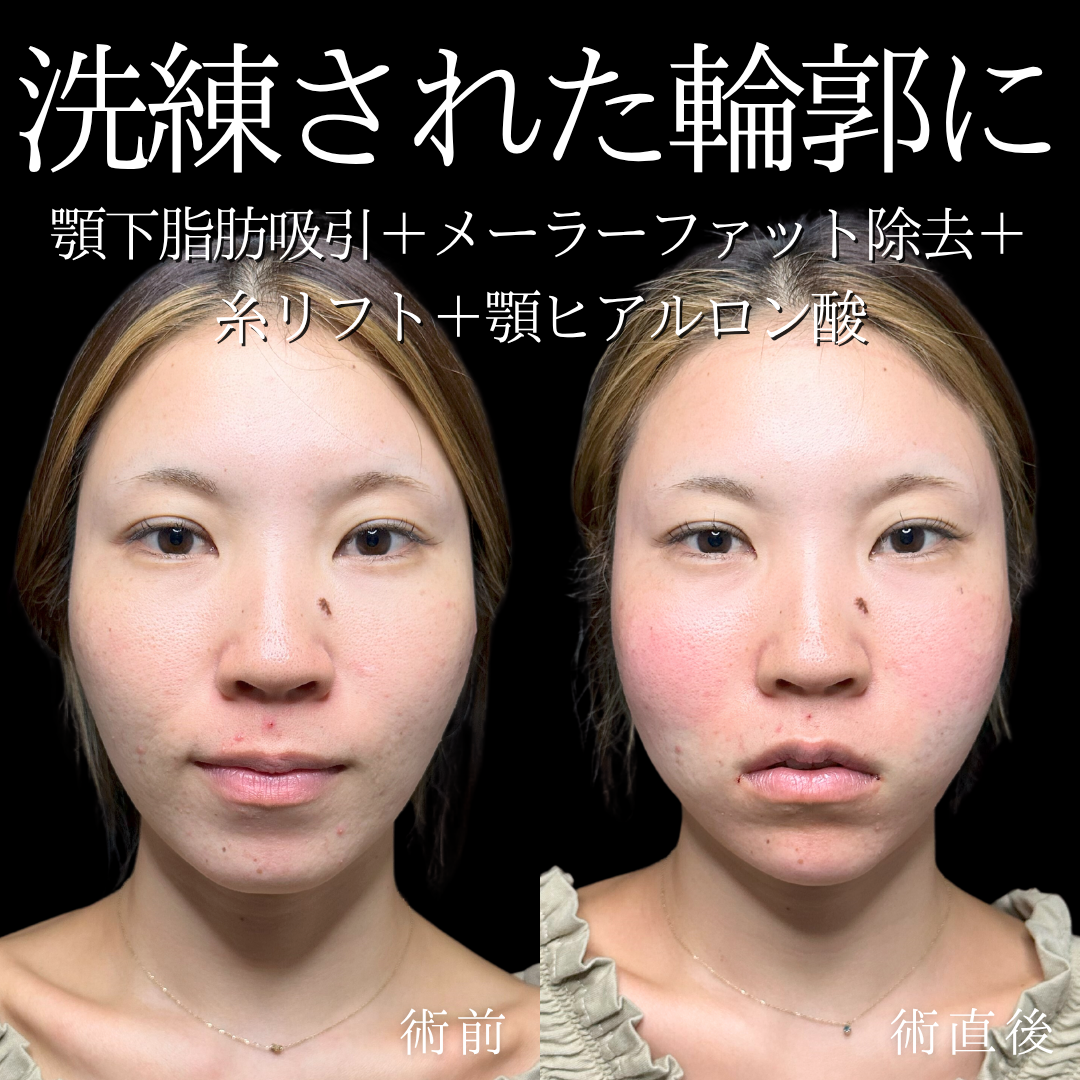 症例イメージ