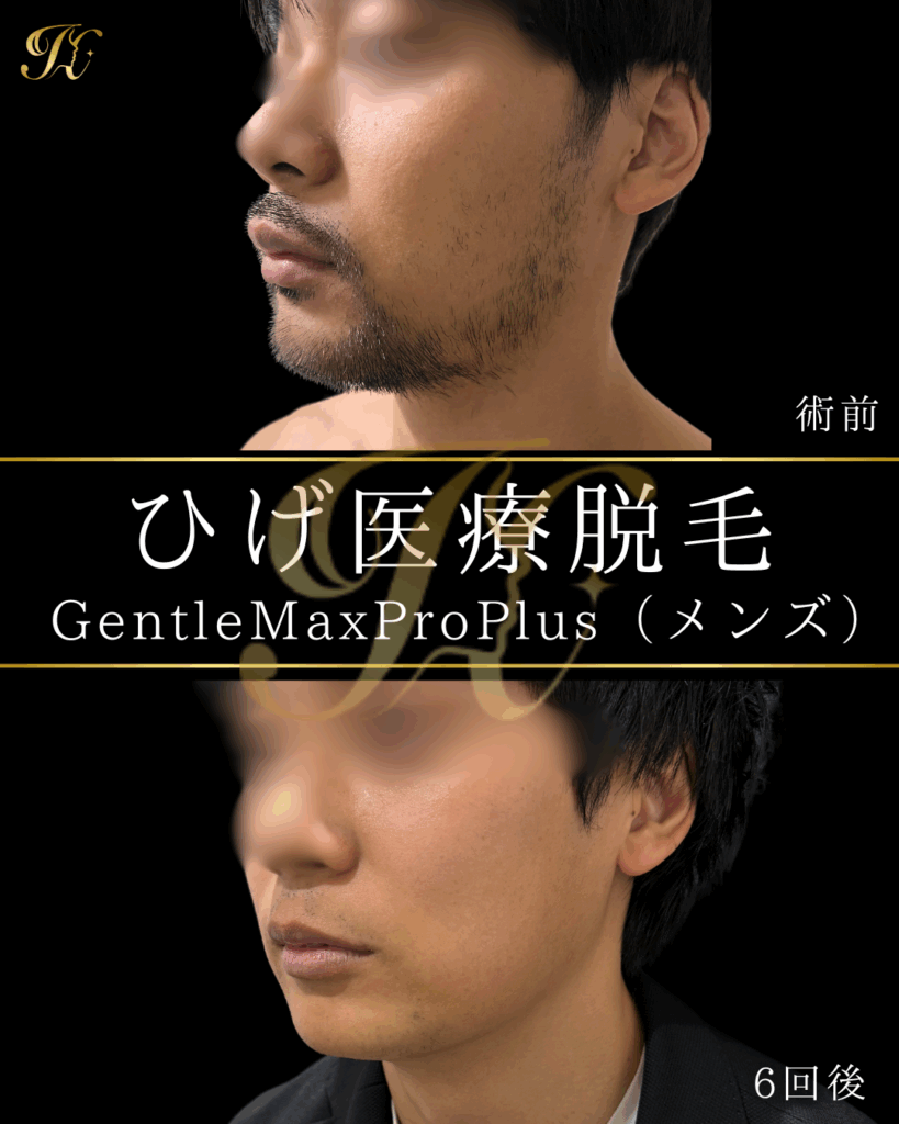症例イメージ