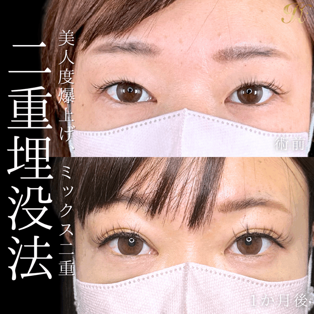 症例イメージ