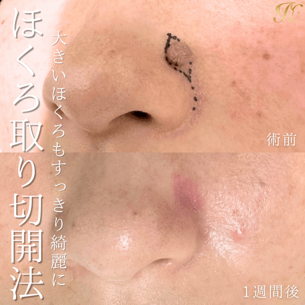 症例イメージ