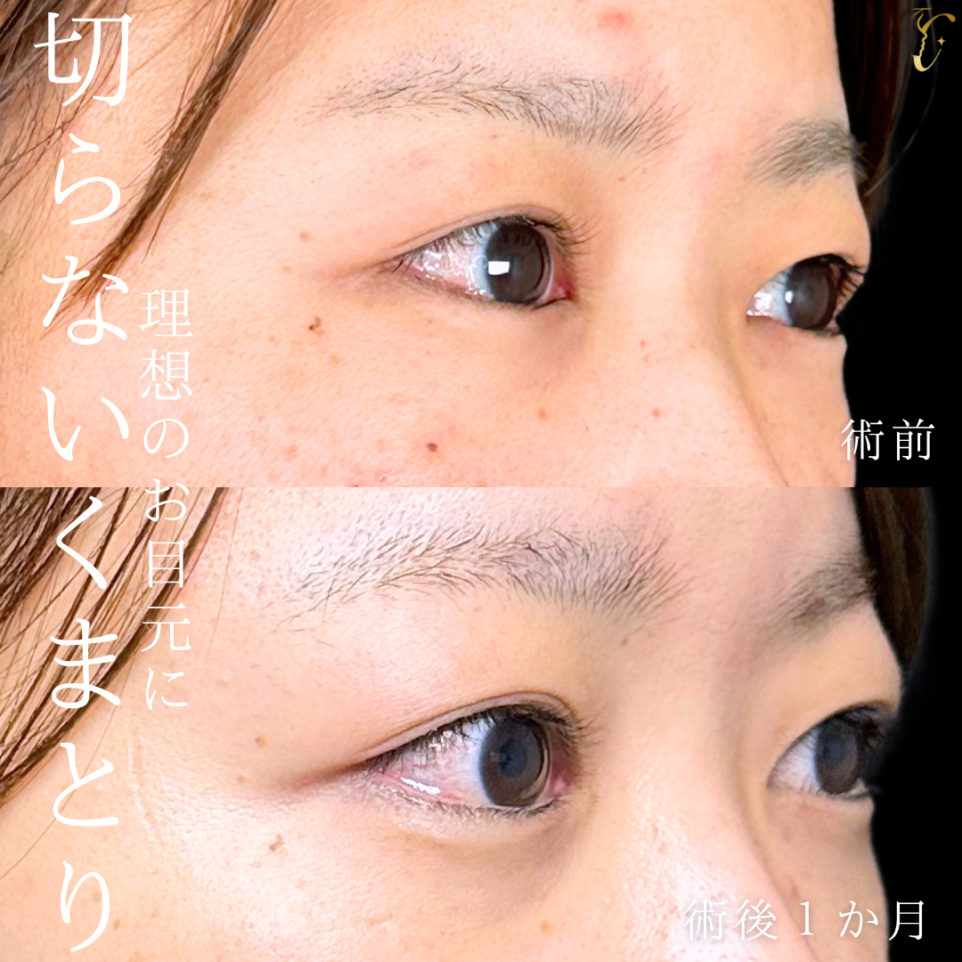 症例イメージ