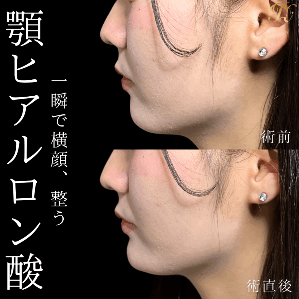 症例イメージ