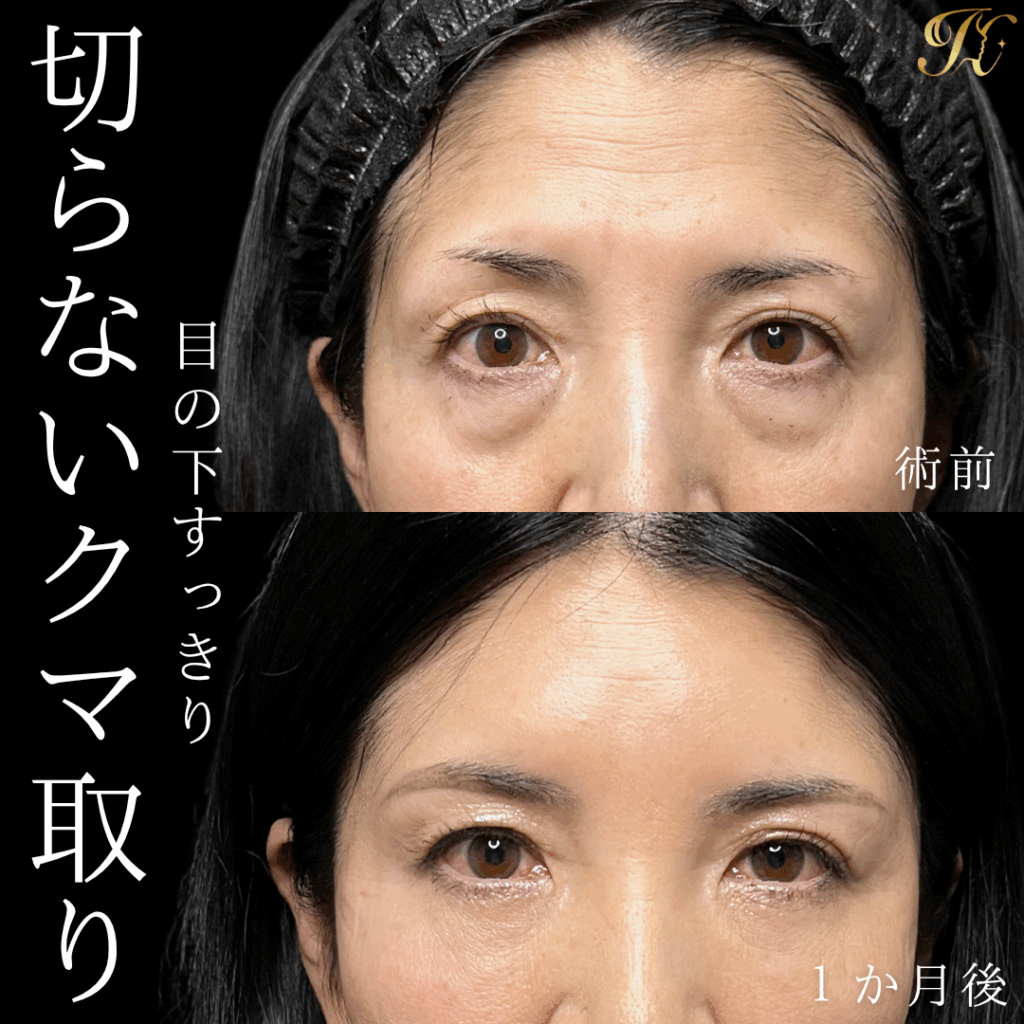 症例イメージ
