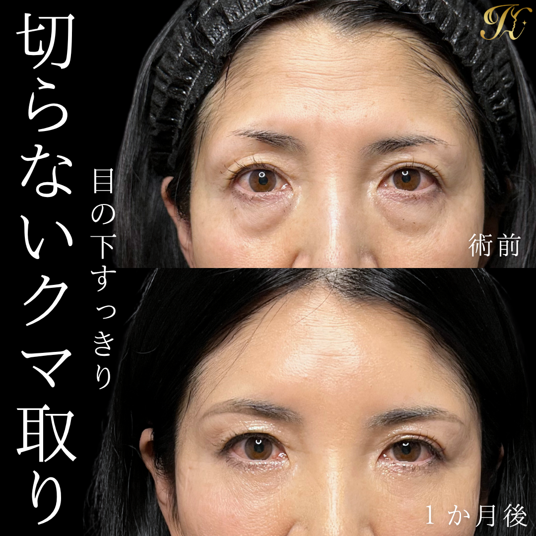 症例イメージ